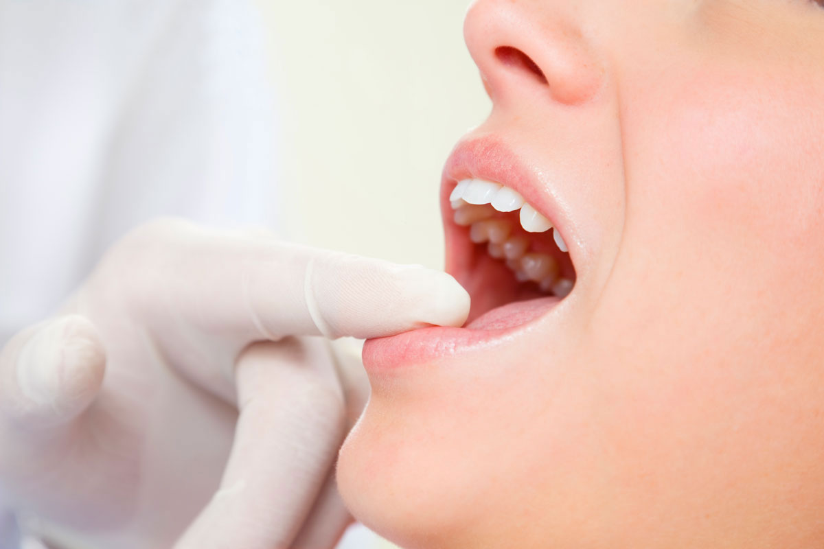 Odontología-conservadora-clinica-dental-tellechea